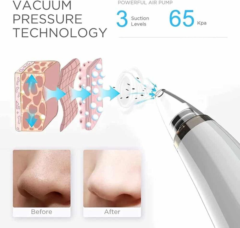 Vacuum Blackhead Remover Cleaner - Image 4