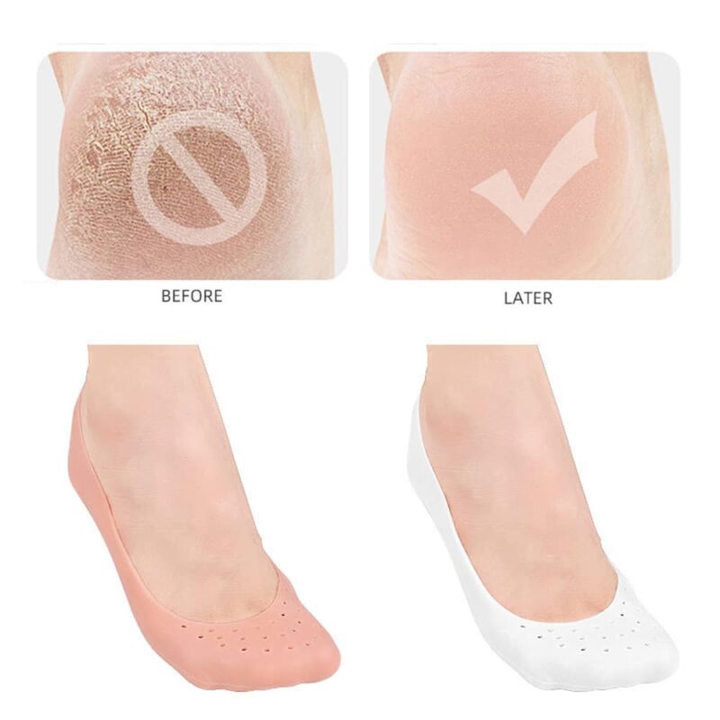 Moisturizing Anti-Crack Silicone Socks for heal cracks and pain relief - Image 3