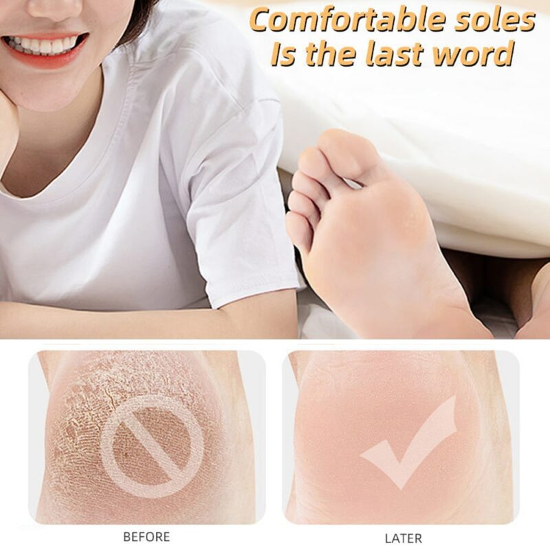 Moisturizing Anti-Crack Silicone Socks for heal cracks and pain relief - Image 6